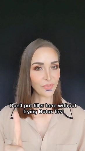 How to soften your chin crease 👇🏼 Botox in the chin muscle helps relax the upward movement of the chin And when combined with Botox in the mouth corners, the frowning motion is minimized ➡️ This helps soften the chin crease If the crease is deep, you'll likely still need filler But getting Botox first prevents the crease from getting worse And sets your filler up for success🙌🏻 Soften your chin crease, SHARE this post 💾 👩‍⚕️ FOLLOW ME ON INSTAGRAM: @ms.glowtox and start making sense of inje