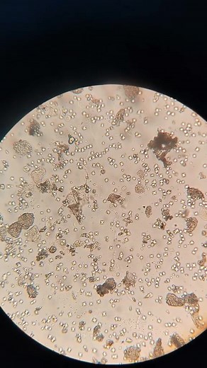 71K views · 1K reactions | Urine sample  #lablife #microbiology | Lab life | Facebook