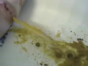 Diarrhea enema in tub
