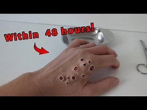 My Trypophobia hand Revealed | What’s Inside? | ASMR Exploration