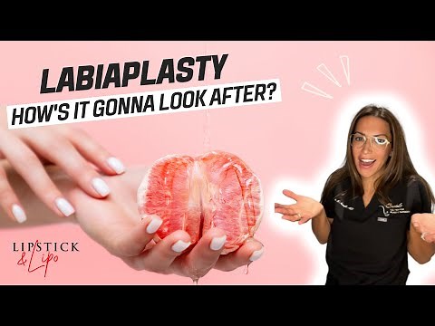 Labiaplasty: What will I look like after?