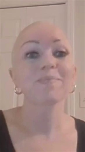 NAAF is recruiting participants for its inaugural class of Teen Advocacy Fellows (TAF) led by Volunteer Coordinator Abby TerHaar. Help us spread the word this Alopecia Areata Awareness Month! The TAF program empowers our young adult community members to share their stories with policymakers to create change for the nearly 7 million Americans affected by alopecia areata. It's a great academic resume builder! Teen Advocacy Fellows: 👉 Are between the ages of 13 and 17 👉 Serve 1 year, starting Jan