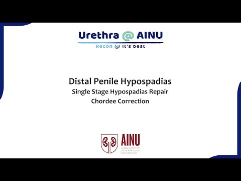 Distal Penile Hypospadias - Single Stage Hypospadias Repair | AINU Surgical Videos