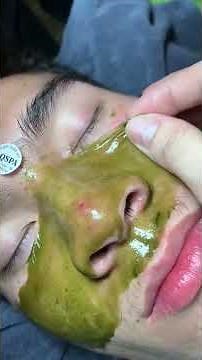 Whitehead + Blackhead Deep Cleaning | Skincare Treatment