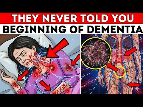 Subcortical Vascular Dementia: Early Signs Doctors Often Miss (Before Memory Loss)