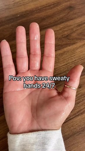 2.2K views · 21 reactions | Does anyone else relate? Sweaty hands gang! Dermadry is an anti-sweat device that has been clinically proven to effectively treat excessive sweating on hands, feet, and underarms. It is easy to use and can provide long-lasting results with regular use. Visit us to know more!  #excessivesweating #solution #selfcare #wellness #hyperhidrosis #sweatypits #sweatproblems #dermadry | Dermadry | Facebook