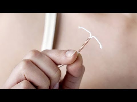IUD most effective birth control option for teens, Canadian pediatricians say