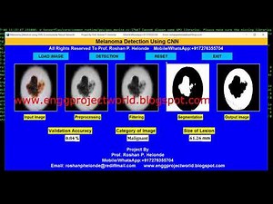 Skin Cancer Detection Using Python OpenCV Project Source Code | Melanoma Lesion Detection Using CNN