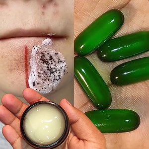 6.8K views · 256 reactions | DIY Homemade Vitamin E Night Serum For Wrinkle Free Glowing Skin | Visible Result Within 7 Days #glowingskin #antiaging #skincare | Anmol Hindi | Facebook