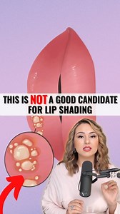 NOT everyone is a good candidate for lip shading⤵️ 💫 One of the biggest concerns is if your client is prone to cold sores. Unfortunately, in my experience, clients prone to cold sores will most likely experience an outbreak after the procedure. This can make the efforts of the procedure seem pointless and could lead to further complications. 💡 It's important to keep in mind that while lip shading is a popular procedure, not everyone is a good candidate for it. It's always best to talk to your 