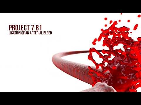 Ligation of an arterial bleed