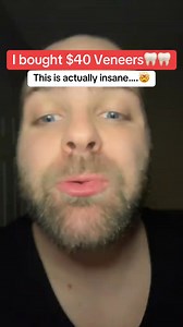 Snow Magic Whitening Booster Powder ✨—because your smile deserves VIP treatment! Just sprinkle, brush, and let the glow-up begin. #snowsmile #whiterteeth #teethwhitening #hack #giftideas #valentinegift #dentalcare #gamechanger | SNOW Teeth Whitening