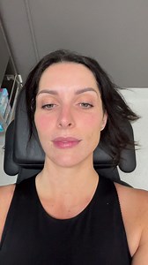 2.5K views | Botulinum toxin injection that is commonly used for anti wrinkle treatment in the upper face. The effects can generally be seen within 1-3 days after the injection, with full results visible within 1-2 weeks. The duration of the effects can vary, but it typically lasts for about 3-4 months. However, this can also depend on individual factors such as metabolism and lifestyle habits | Newcastle Cosmetic Doctor | Facebook