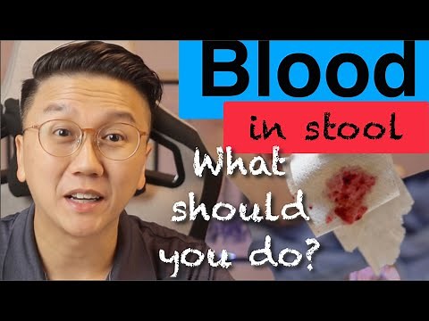 Blood in Stool Causes? Dangerous Signs, Symptoms & Treatments