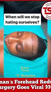East African Undergoes Forehead Surgery, Goes Viral. **Celebrating African Foreheads** The ongoing effort to reclaim and celebrate African identity remains vital for contemporary African and diaspora communities. Cultural imperialism, deeply rooted in many African societies, often imposes the dominant culture’s values, beliefs, and norms, which are frequently presented as universal or superior. As plastic surgery becomes a popular solution for perceived body imperfections, procedures like the on