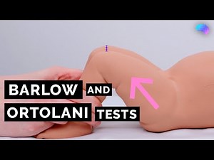 Barlow, Ortolani and Galeazzi tests | NIPE | OSCE | CPSA | PLAB 2
