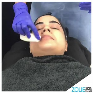 #zolieskin Dermaplaning is a method of exfoliation that consists of...