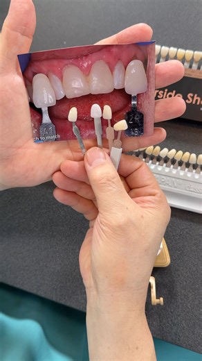 How to matching pinkish color??? More information? Lsk121.com/shadeguide | CEO Luke Kahng