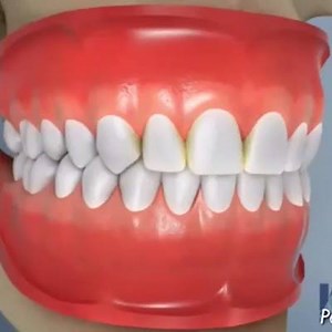 1K views · 14 reactions | how to floss your teeth #teeth#tooth#toothless#extraction#cirugiabucal#oralsurgery#dental#dentist#dentistry#dentistrymyworld#dentalhygiene#dentalassistant#dentalschool#dentalstudent#dentalhygiene#implant#implants#odonto#odontogram#odontologo#odontolove#odontología#odontologia#odontogram#odontoporamor#estomatología#prosthesis#prosthodontics#braces#dentures#smile | All Dental / Вся стоматология | Facebook