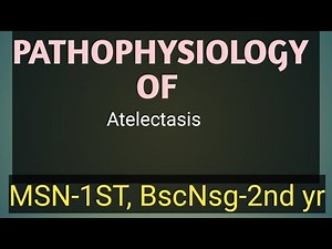 pathophysiology of Atelectasis