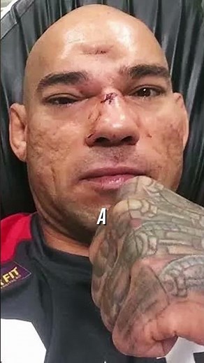 The most bizarre injury in MMA history! #mma #bellator #knockout