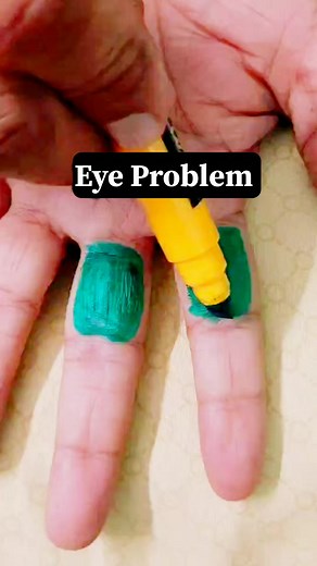 Eye problem Solution.. #eyesight #eyecare #vision #eyes #eyehealth #glasses #eye #optometrist #eyedoctor #optometry #health #eyesurgery #eyewear #sight #healthcare #eyeglasses #ophthalmology #eyeexam #optical #cataract #doctor #eyecaretips #optician #sunglasses #glaucoma #healthyeyes #eyetreatment #ophthalmologist #visioncare #eyeprotection #colourtherapy #reels | Vishal Bodhi
