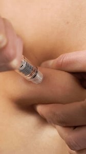 Une femme injectant des hormones dans : vidéo de stock (100 % libre de droit) 3463047019 | Shutterstock