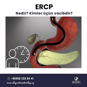 ERCP (Endoskopik retroqrad xolangiopankreatoqrafiya - #Endoscopic retrograde #cholangiopancreatography)- kombinəolunmuş müalicə-diaqnostik prosedur olub, endoskopik və rentgenkontrast üsulların birgə tətbiqini özündə birləşdirir. #ERCP üsulu öd yollarından daşların çıxarılması, öd yollarında şişlərin diaqnozu və tıxanma nəticəsində yaranan sarılığın müalicəsi üçün öd yollarına stent qoyulmasıdır. ERCP öd yolları iltihabı, öd çöküntüsü və öd yolları daşlarından əziyyət çəkən xəstələr üçün ən yaxş