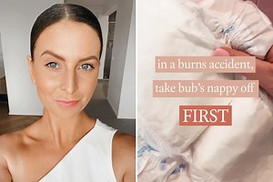 Paramedic warns you should ALWAYS take baby's nappy off first in hot water burn