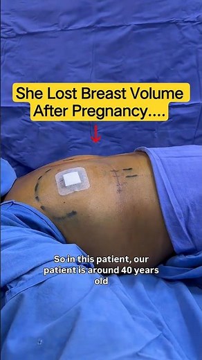 She Lost Volume After Pregnancy: Breast Augmentation For Moms! | Dr DC, Plastic Surgeon