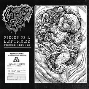 Fetal Deformity - Pieces Of A Deformed Unborn Infants