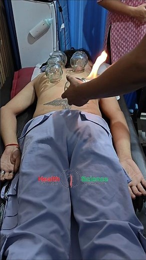 Fire Cupping Therapy for Back Pain | Instant Relief for Upper & Lower Back | Natural treatment