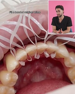 26K views · 31 reactions | Dentist Reacts To Incredible Dental Procedures video by Burst Out Loud | Beautylicious | Facebook