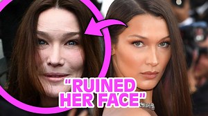 5.1K views · 16 reactions | Top 5 BOTCHED Celebrity Plastic Surgeries That Made Them Shockingly Unrecognizable - Part 2 | Landonproduction | Facebook