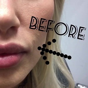 Skin Perfect Medical on Reels