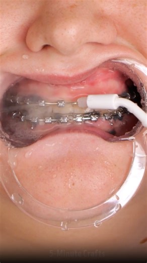 186K views · 240 reactions | Solutions to frequent safety issues and hacks! | 5-Minute Crafts | Facebook