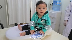 Doctor Examines Child Malnutrition Measuring Malnutrition Stock Footage Video (100% Royalty-free) 1082846122 | Shutterstock