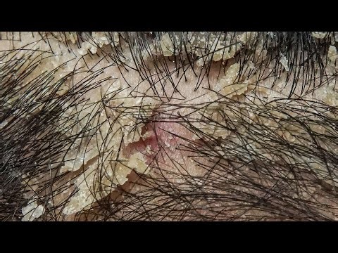 Ultimate Relaxation with Comb #DKMOR235-3