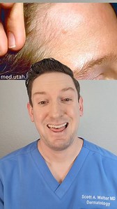 Have you heard of basal cell carcinoma or known someone who's had it? Here's how to spot a basal cell carcinoma. #basalcellcarcinoma #skincancer #bcc #skincancerawareness #dermatologist #skin #recurringpimple #whatsonmyskin #whatsonmyface | Scott Walter MD, FAAD