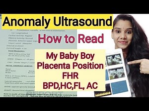 Anomaly Scan 20 weeks घर पर कैसे पड़े ।Anomaly Scan Baby Boy or Baby Girl How to Read level 2 report