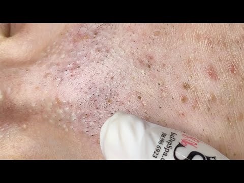 Relax Every Day With Sac Dep Spa (Long P1.1) #0366