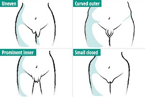 There's no such thing as a normal vagina - the 8 different types of labia revealed