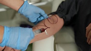 L'infirmière prélève le sang de la : vidéo de stock (100 % libre de droit) 3926774463 | Shutterstock