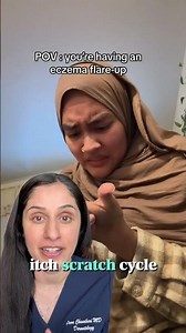 Derm reacts to eczema flare & shares itch tips