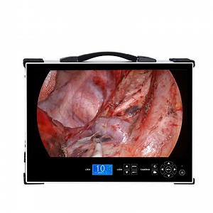 [Hot Item] 1080P HD Endoscope Inspection Camera with Powerful 80W Light