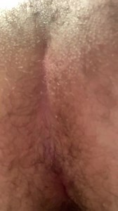 ASS EXPLOSION 2 (SNAP, CRACKLE, POP)