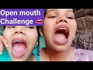 ✨😲 Open Mouth Challenge | Can You Believe This? ✨Extreme Open Mouth Challenge! 👄 (Must Watch)