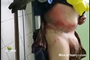 Infected Belly And Balls