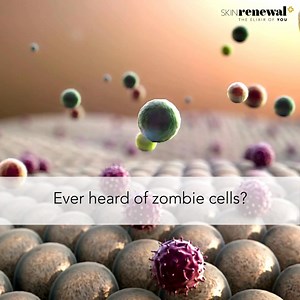 What Are Zombie Cells? Meet senescent cells—also known as "zombie cells." These damaged skin cells hang around instead of renewing, affecting surrounding healthy cells and accelerating signs of ageing. They're triggered by factors like UV exposure, stress, and time, creating a cycle of skin damage. At Skin Renewal, we target ageing at its roots with treatments designed to rejuvenate your skin by minimising the impact of these zombie cells. Think of healthier skin, improved texture, and a more yo