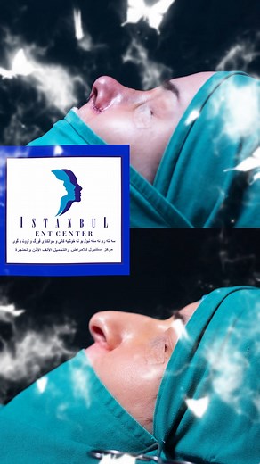 Istanbul ENT Aesthetic Center on Reels